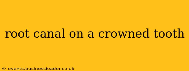 root canal on a crowned tooth