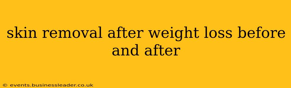 skin removal after weight loss before and after