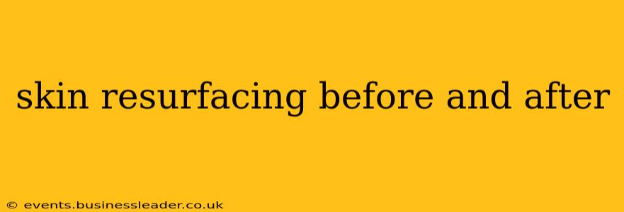 skin resurfacing before and after