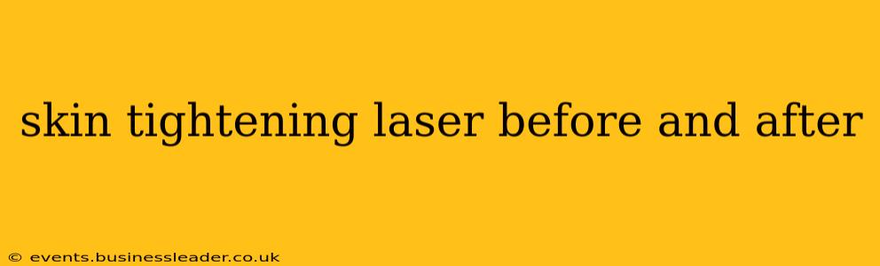 skin tightening laser before and after