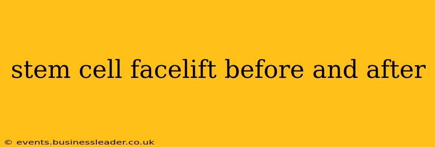 stem cell facelift before and after