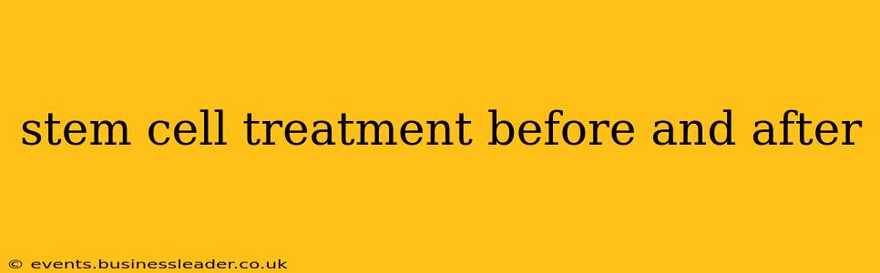 stem cell treatment before and after