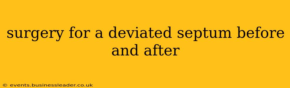 surgery for a deviated septum before and after