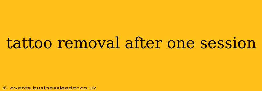 tattoo removal after one session