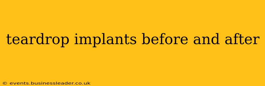 teardrop implants before and after