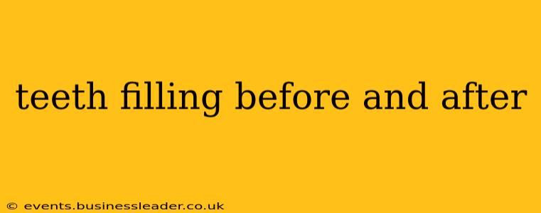 teeth filling before and after