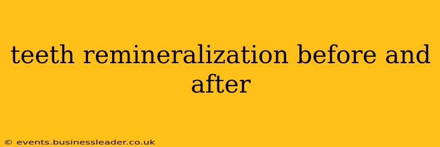 teeth remineralization before and after