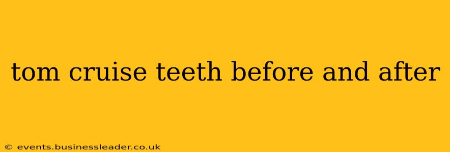 tom cruise teeth before and after
