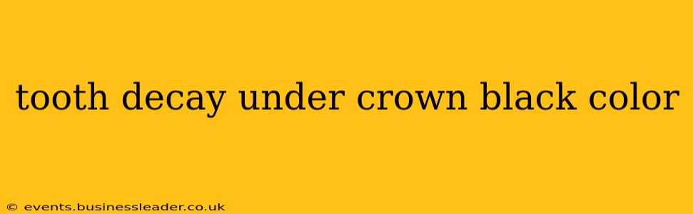 tooth decay under crown black color