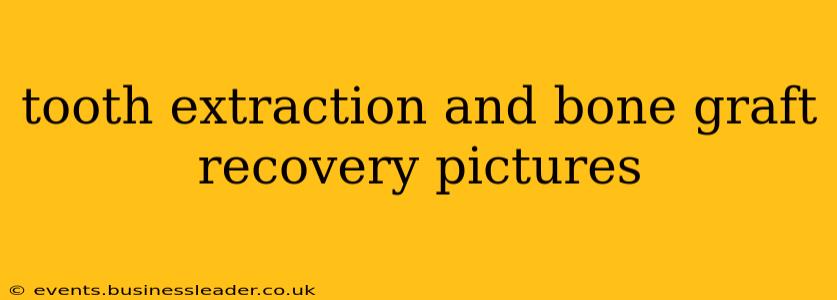 tooth extraction and bone graft recovery pictures