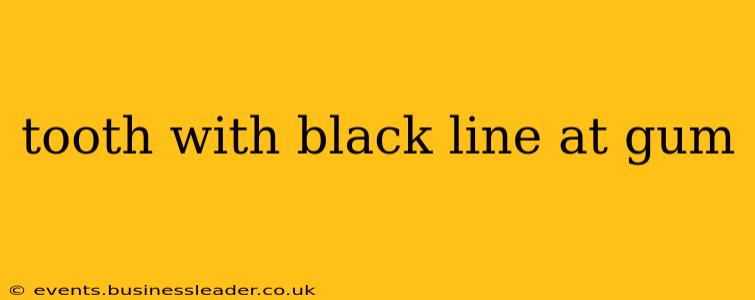 tooth with black line at gum