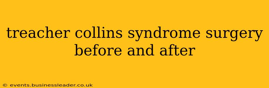 treacher collins syndrome surgery before and after