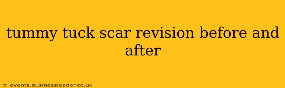 tummy tuck scar revision before and after