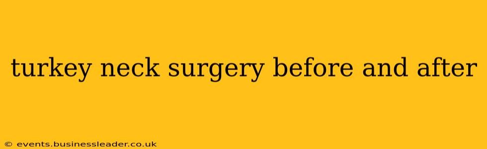 turkey neck surgery before and after