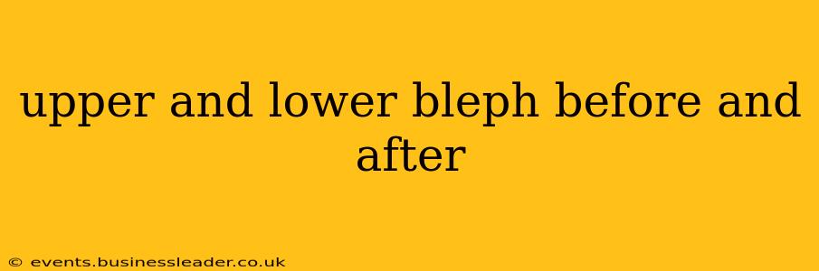 upper and lower bleph before and after