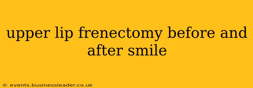 upper lip frenectomy before and after smile