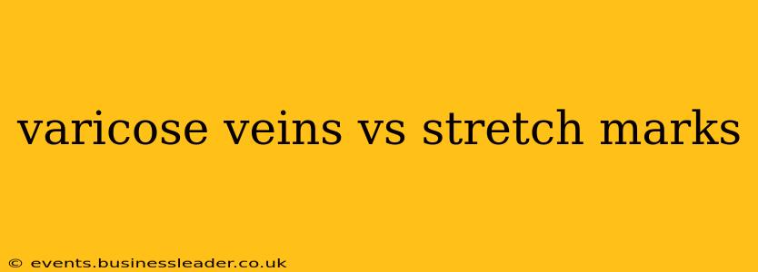 varicose veins vs stretch marks