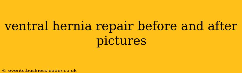 ventral hernia repair before and after pictures