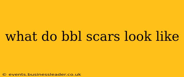 what do bbl scars look like