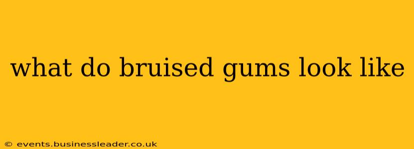 what do bruised gums look like