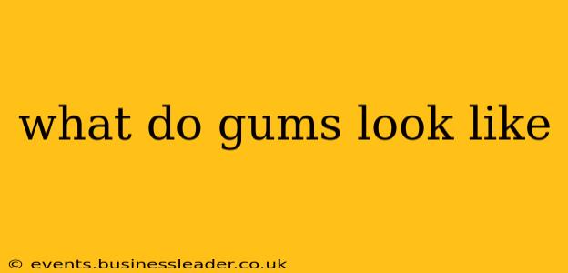 what do gums look like