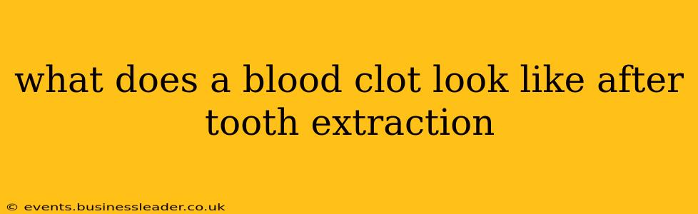 what does a blood clot look like after tooth extraction