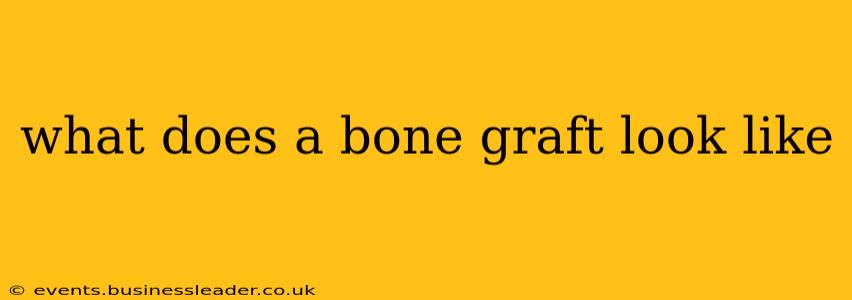 what does a bone graft look like