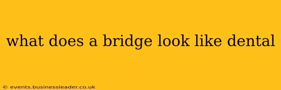 what does a bridge look like dental