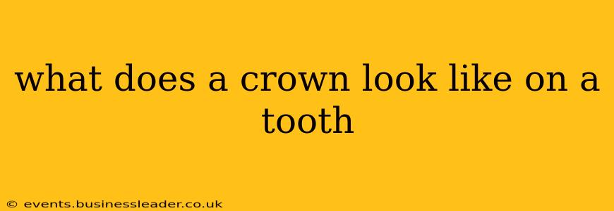 what does a crown look like on a tooth