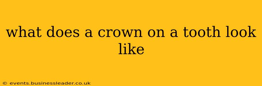 what does a crown on a tooth look like