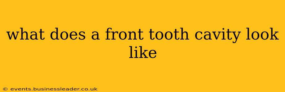 what does a front tooth cavity look like