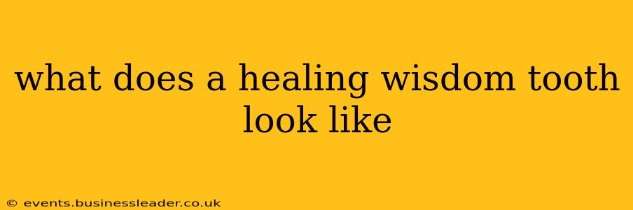 what does a healing wisdom tooth look like