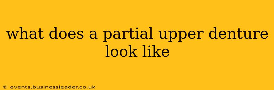 what does a partial upper denture look like