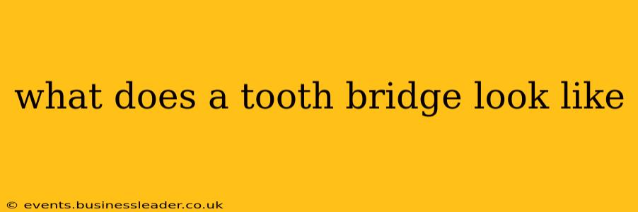 what does a tooth bridge look like