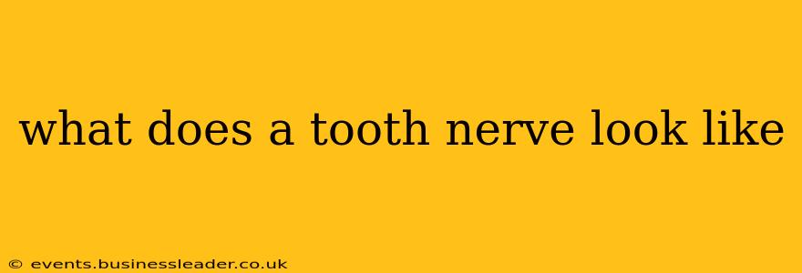 what does a tooth nerve look like