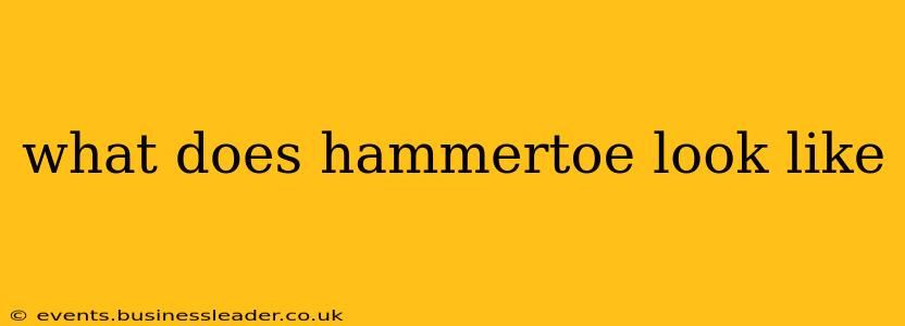 what does hammertoe look like