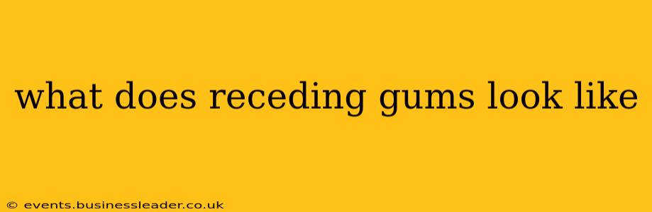 what does receding gums look like