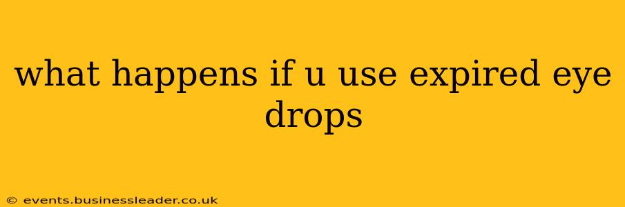 what happens if u use expired eye drops