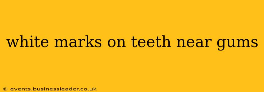 white marks on teeth near gums