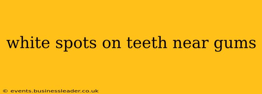 white spots on teeth near gums