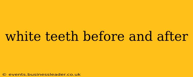 white teeth before and after
