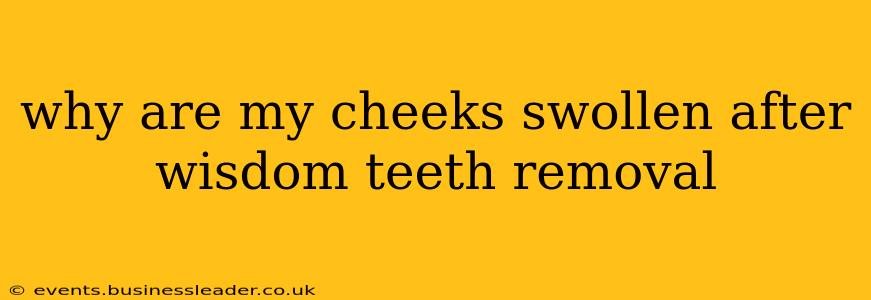 why are my cheeks swollen after wisdom teeth removal