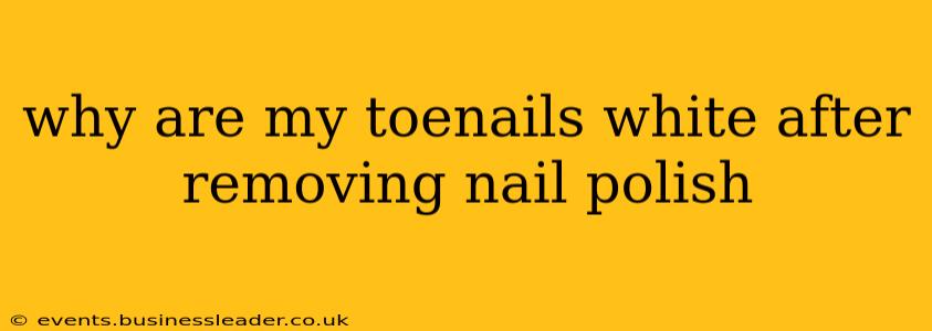 why are my toenails white after removing nail polish