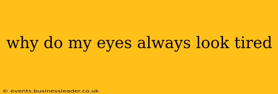 why do my eyes always look tired