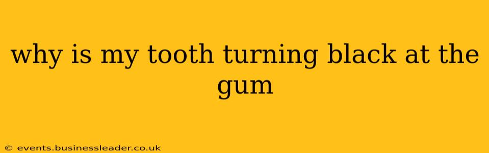 why is my tooth turning black at the gum
