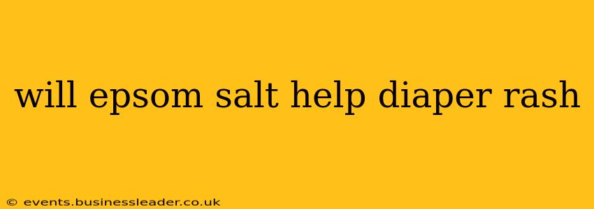 will epsom salt help diaper rash