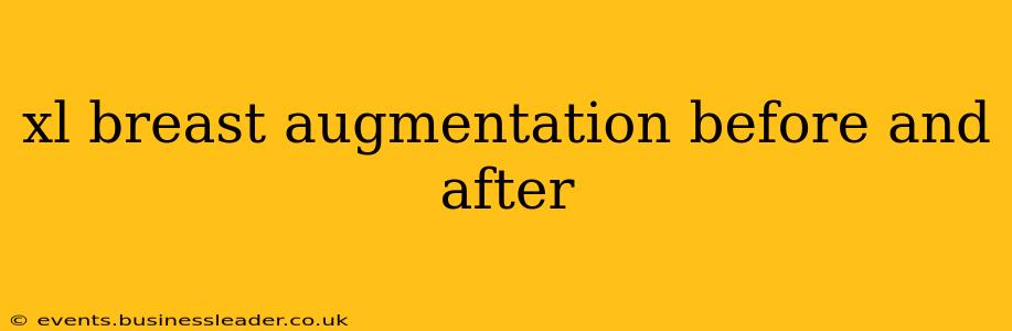 xl breast augmentation before and after