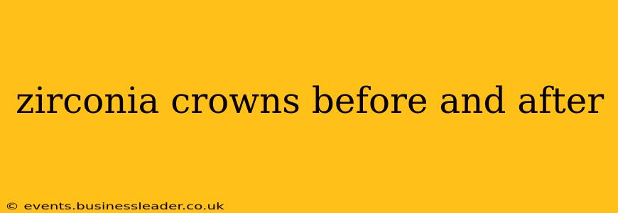 zirconia crowns before and after